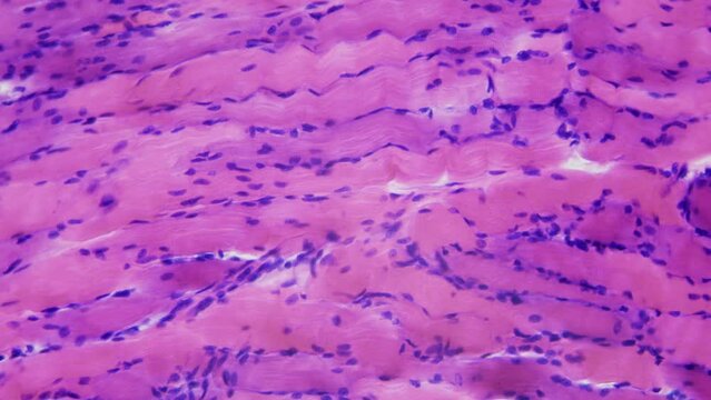 Human skeletal muscle tissue under microscope, 400x zoom . Longitudinal section. Highly organized tissue composed of bundles of muscle fibers called myofibers which contain several myofibrils