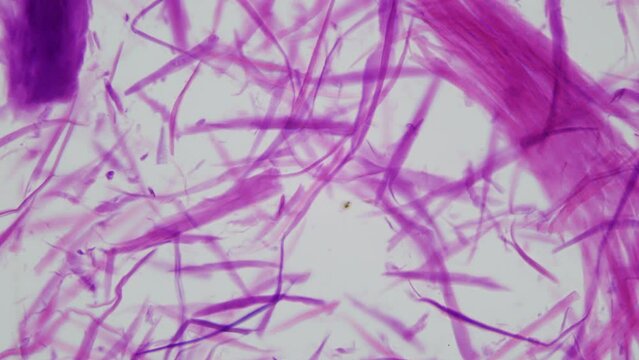 Human smooth muscle fibers under a microscope. The main muscle of the human internal organs from the intestines to the bladder, etc.