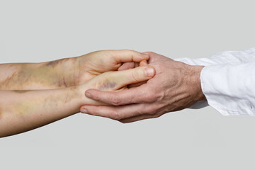 Patient with bruises and doctor hand closeup. Supporting victims of domestic violence