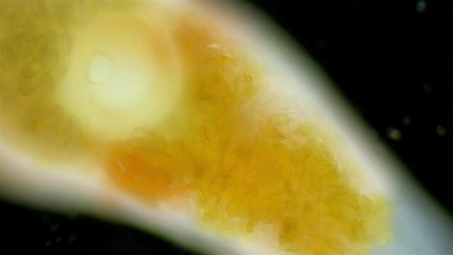 Parasitic worm Progonus muelleri under a microscope, at metacercaria stage. Class Trematoda. White Sea