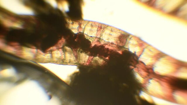 intestine of nematode under the microscope, 150x magnification