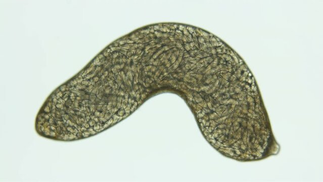 Sporocyst stage of parasitic worm Podocotyle sp. under a microscope, family Opecoelidae. Cercaria larvae develop inside it. Mollusca host. White Sea