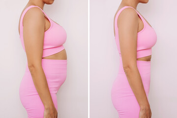 Woman in a pink tracksuit with a belly with excess fat and toned slim stomach before and after losing weight on a gray background. Result of diet, liposuction, training. Getting rid of overweight - obrazy, fototapety, plakaty