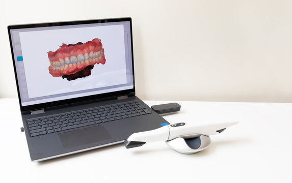 3D Scanned Picture of Scanned Teeth on Monitor of Computer, Notebook. White 3d Intraoral Dental Tooth Scanner Lying on Table. Copy Space. Dental Equipment, Device For Scanning Teeth. Horizontal