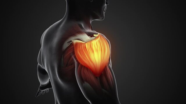 Pain and damage in the shoulder muscles