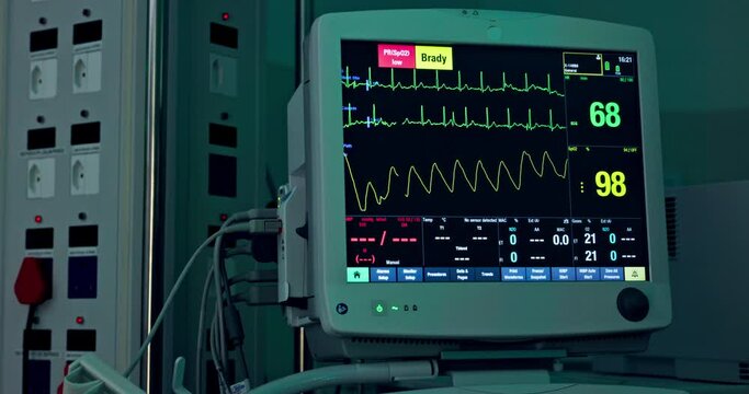 Hospital, digital machine or heart monitor in theater, clinic or operation room for surgery or cardiology. Background, medical or professional tech with ecg screen for cardiovascular check in icu