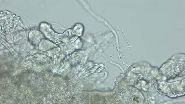 Larvae of parasitic worm Progonus muelleri under a microscope, at Cercaria stage. Class Trematoda. Got out of Sporocyst. White Sea