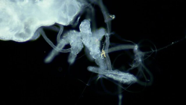 Larvae of parasitic worm Progonus muelleri under a microscope, at Cercaria stage. Class Trematoda. Got out of Sporocyst. White Sea