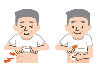 湿疹の症状と薬を塗るシニア男性のイラスト