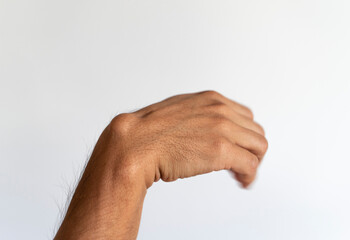 Ganglion cyst on man's hand on white background