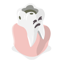 3D Isometric Flat Vector Illustration of Tooth Decay, Dental Problems. Item 2