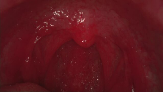 Real video of a human throat. Macro frame inside the mouth. Teeth and jaw, soft tissues of the cheeks. Tongue surfaces, taste buds. The throat and uvula are moving.