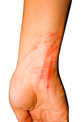 Fototapeta premium Cat scars and bite marks.