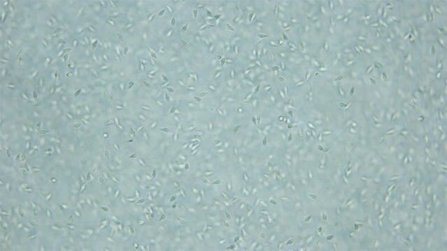 Sperm (spermotozoa) sea urchin Strongylocentrotus pallidus under microscope, phylum Echinodermata. White sea