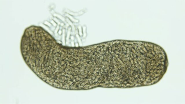 Sporocyst stage of parasitic worm Podocotyle sp. under a microscope, family Opecoelidae. Cercaria larvae develop inside it. Mollusca host. White Sea