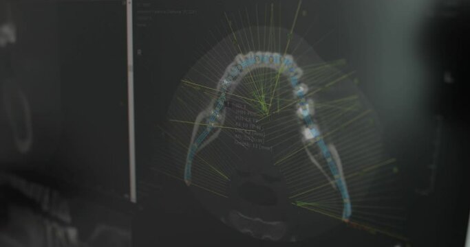X-rays of the jaws on the screen in the dental office