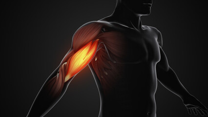 Pain and injury in the Biceps Muscles
