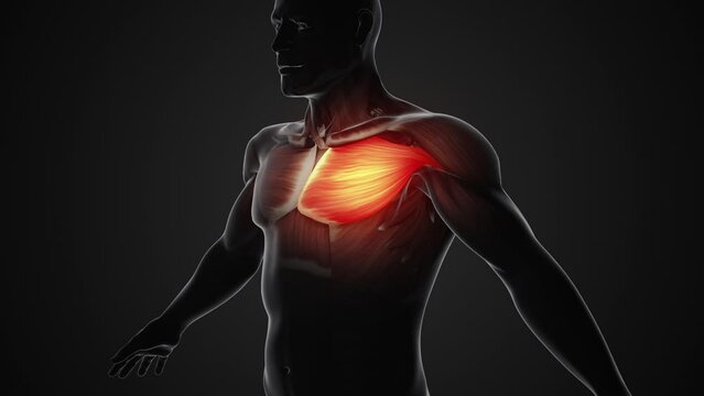 Pain and injury in the Chest Pectoralis Muscles