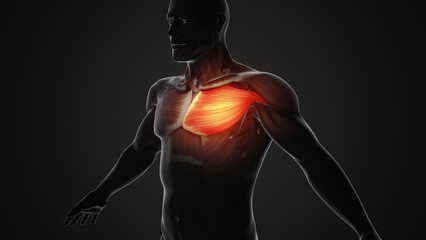 Pain and injury in the Chest Pectoralis Muscles