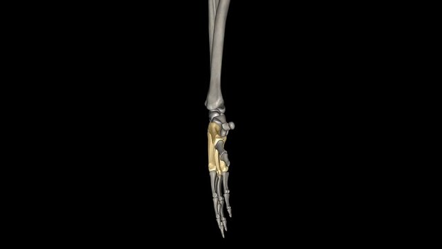The metacarpals are long, thin bones that are located between the carpal bones in the wrist and the phalanges in the digits .