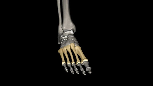 The metatarsal bones are the bones of the forefoot that connect the distal aspects of the cuneiform .