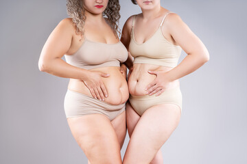 Tummy tuck, two fat women with flabby bellies on gray background, plastic surgery and body positive...