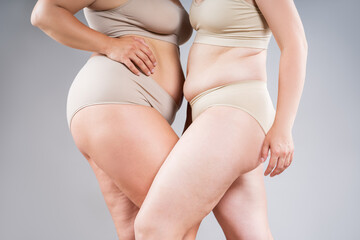 Two overweight women with fat flabby bellies, legs, hands, hips and buttocks on gray background, plastic surgery and body positive concept