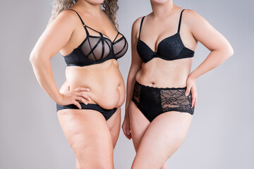 Tummy tuck, two fat women with flabby bellies in black lingerie on gray background, plastic surgery and body positive concept - obrazy, fototapety, plakaty