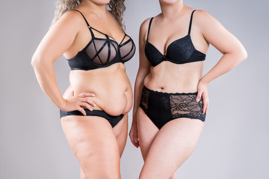 Tummy tuck, two fat women with flabby bellies in black lingerie on gray background, plastic surgery and body positive concept