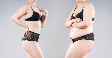 Woman's fat body before and after weight loss on gray background, tummy tuck, liposuction and...