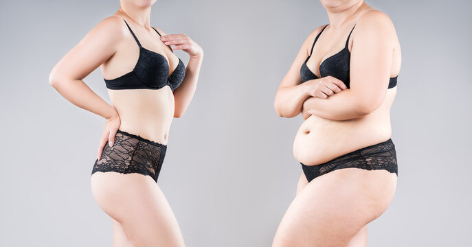 Woman's fat body before and after weight loss on gray background, tummy tuck, liposuction and plastic surgery concept