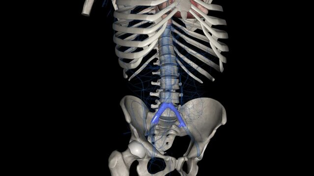 The common iliac vein is formed by the unification of the internal and external iliac veins .