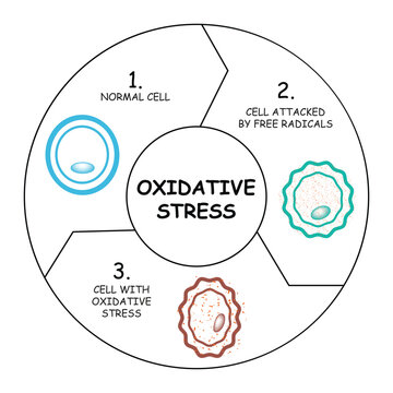 Oxidative Stress, free radicals and antioxidants, Normal Cell, Cell Attacked by Free Radicals, Cell With Oxidative Stress. Vector Illustration.