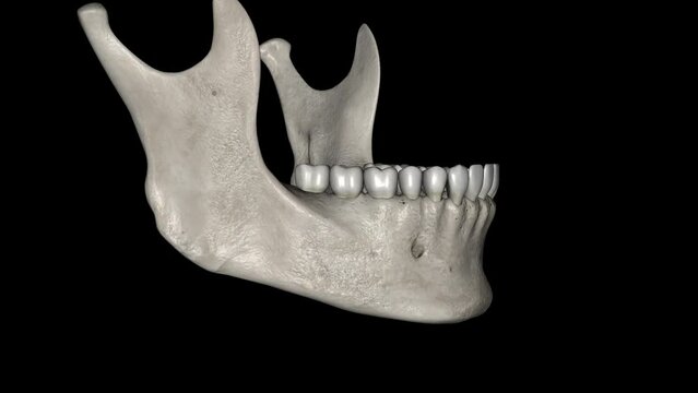 The mandible is the largest and strongest bone of the human skull.