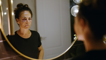Middle age hispanic woman suffering for domestic violence looking on mirror bruise on eyes at bathroom - obrazy, fototapety, plakaty