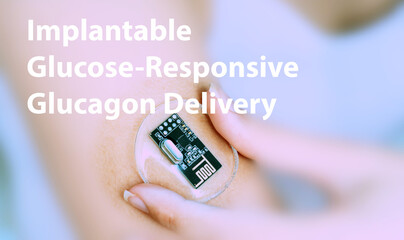 Implantable Glucose-Responsive Glucagon Delivery Systems Implantable E
