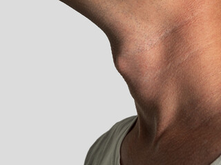 Anatomy of the laryngeal cartilage in men, Adam's apple in men selective focus
