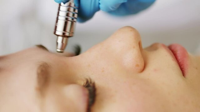 Beautician cosmetologist makes a procedure Microdermabrasion peeling of the face skin. Hardware cosmetology in clinic salon for client. Diamond face clean.