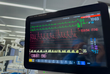hospital monitor displaying vital signs: heart rate, blood pressure, temperature, and pulse oximetry, highlighting advanced medical technology in patient care