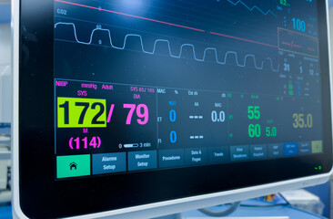 hospital monitor displaying vital signs: heart rate, blood pressure, temperature, and pulse...