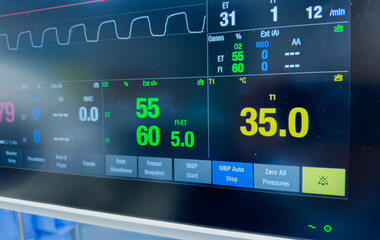 hospital monitor displaying vital signs: heart rate, blood pressure, temperature, and pulse oximetry, highlighting advanced medical technology in patient care