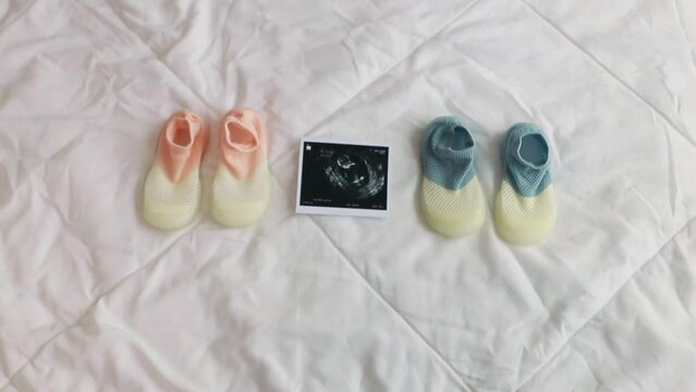 Top view of two pairs of colorful baby shoes and an ultrasound photograph of a fetus laying on a bed.