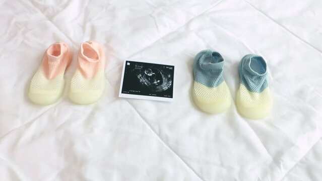 Top view of two pairs of colorful baby shoes and an ultrasound photograph of a fetus laying on a bed.