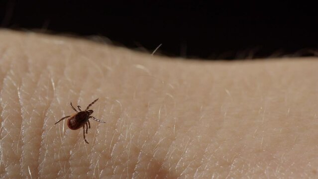 Closeup view of parasitic tick walking over fine hairs on caucasian skin