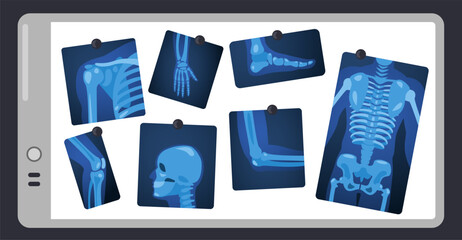 X ray on doctor screen. Human skeleton parts on surgery light pad, body parts medical x-ray concept. Vector illustration