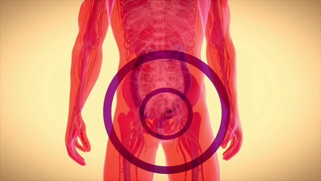 4K abstract animation of the colon cancer