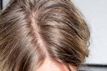 Gray hair on blonde hair. Close-up of the top of the head with the parting