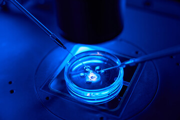 Closeup of ICSI procedure being carried out in Petri dish - obrazy, fototapety, plakaty