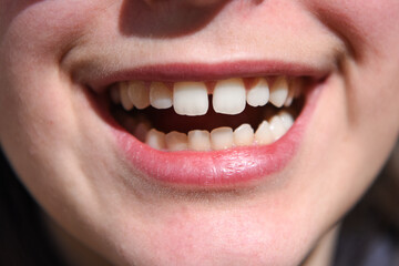 denti dentista sorriso 