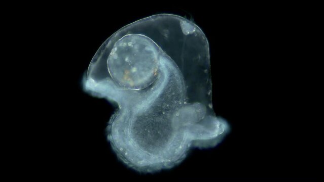 Pilidium larva of worm Heteronemertea under microscope, genus Cerebratulus ssp. With help of cilia, it floats in the water column. White sea